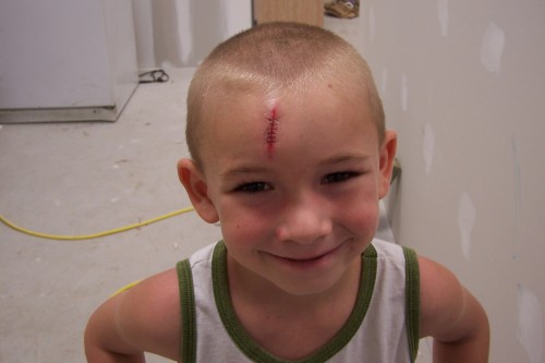 Rylan got to excited about helping and ran through a door way  (door to small LOL)